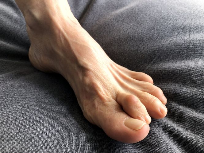 Hovedbilde Hammer Toe Straightening Strap - hammertåortose